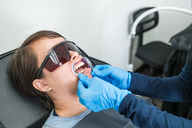 Emergency Dental Filling Replacement in FL